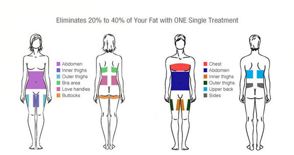 treatment areas treatment areas