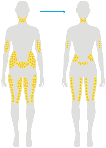 1550545761547859.png coolsculpting-fat-reduction.png