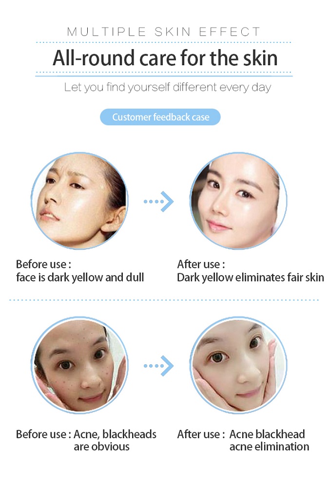 1563243067138013.jpg SPA608详情图-04.jpg